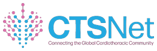 CTSNet